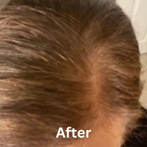 FullyVital Hair Serum - Image 5